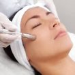 Micro Derma brasion